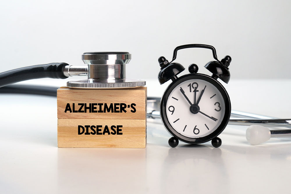 Alzheimer’s disease – 7 tips to manage the condition